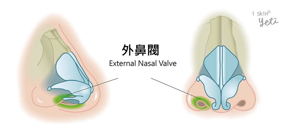 外鼻閥結構