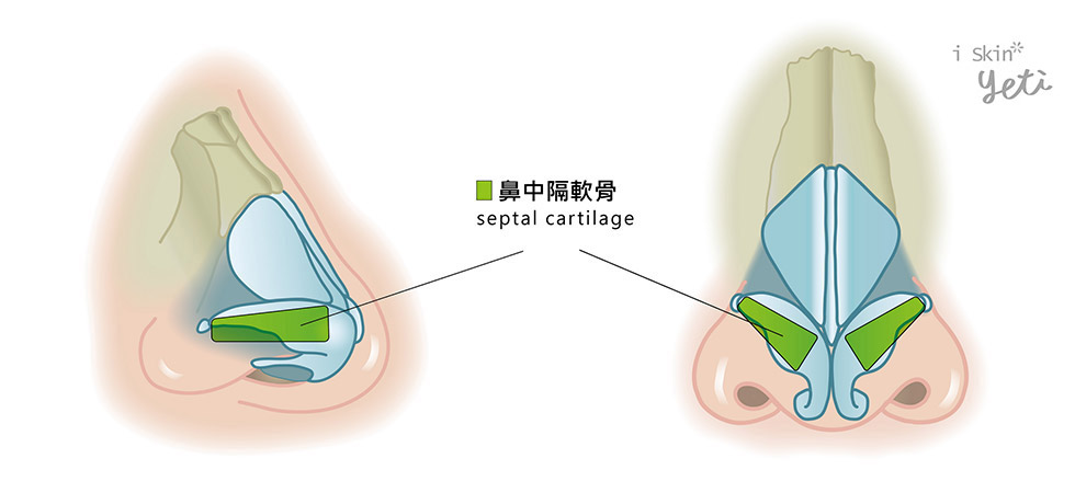 外鼻閥重建手術